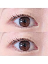 オルト(ORT)/ラッシュリフト