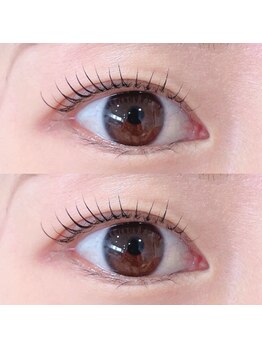 オルト(ORT)/ラッシュリフト