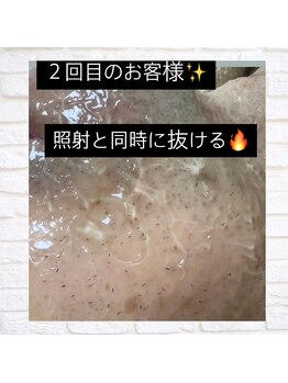 ピュアン(PyuAn)/１回あたりの効果が絶大☆