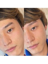 ホワイトアイ 茶屋町(WHITE EYE)/《眉毛/アイブロウ/美眉/梅田》