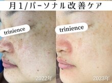 トリニエンス 新宿店(TRINIENCE)/40代/パーソナル改善ケア