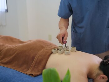 ひふみ鍼灸院/鍼施術