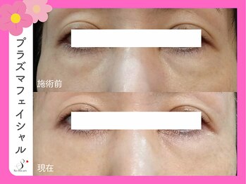 ソーハート(So Heart)/☆ 目元のお悩みにも ☆