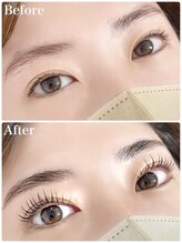 レピア 郡山駅前店/韓国式LEPIA Before&After