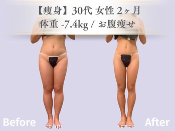 ベルペール(Belle perle)/痩身|デトックス×インドエステ