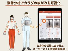 博多おかげ整体院/最新姿勢分析シセイカルテ導入◎