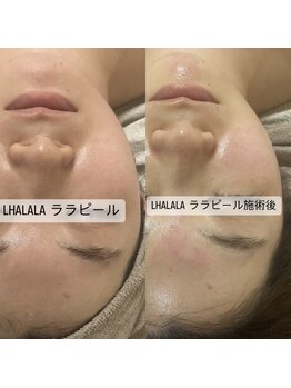 グラン ジュテ/LHALALA &nbsp;ララピール