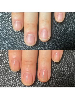 プルームネイル(plume.nail)/自爪育成