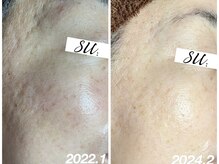 スウ(su:)/ふわふわツヤ肌美人に