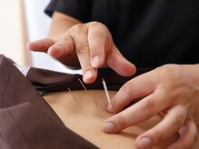 鍼灸整体院かけはし