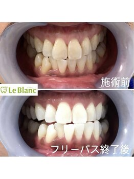 ルブラン 奈良店(Le Blanc)/仕事終わりに!