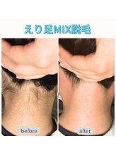 カルーナ 住吉店/えりあしMIX