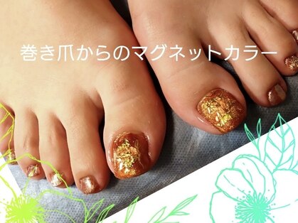 ジェネシス(GENESIS)の写真