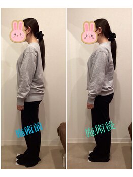 うちんだい整骨院 整体院/30代女性/骨盤矯正 施術事例