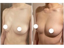 スマイルクルー(SmileClue)/ビフォーアフター症例