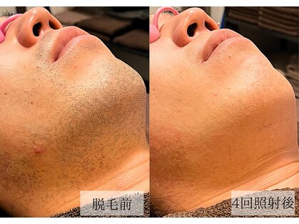 メンズアルファの写真