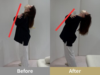 せなかのはね 難波心斎橋店/30代 女性 猫背 肩こり