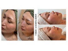 ビオン 松戸(bion)