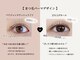 ビセオ(ViSEO)の写真