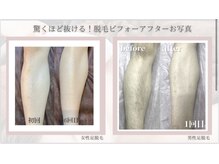 フォフォ 仙台泉店(Fofo)/光美肌脱毛機械