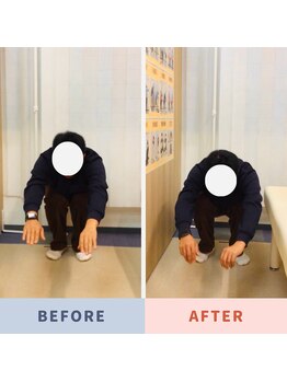 ナオル整体 三鷹院(NAORU整体)/20代男性施術事例【しゃがみ】