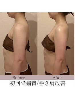 ピーチハート(Peach Heart)/黄金比小顔全身コルギ