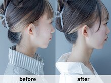 アルムボーテ 代官山 恵比寿(ARUIM Beaute)/シェービングビフォーアフター