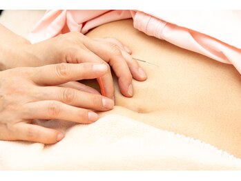 高麗鍼灸院/お腹の鍼