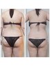 【ガッツリ痩身】最強痩身機器3台使用！！1回で驚く変化！！59400円→22000円