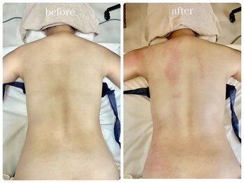 コア(Coeur)/最新マシーン★神の手ウルトラ