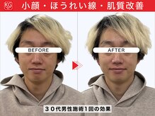 顔ジム 麻布十番店/