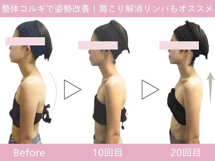 小顔フェイスラボ 市川店(小顔FaceLabo.)の写真