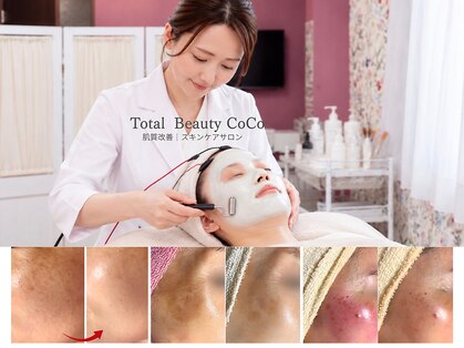 トータルビューティー ココ(Total Beauty CoCo)の写真