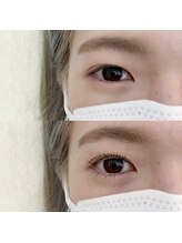 フランセス(Frances)/上下ラッシュリフト