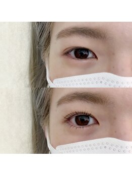 フランセス(Frances)/上下ラッシュリフト