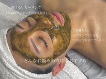 アンドナイン エス店(ANDNINE.)/美肌革命★ハーブピーリング