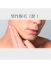 ≪男性≫髭脱毛￥4000