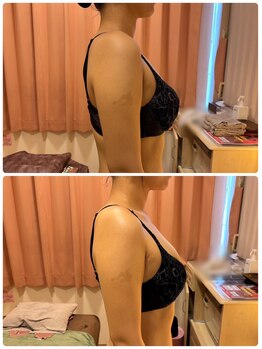 レイビス 仙台店(RAYVIS)/姿勢改善2