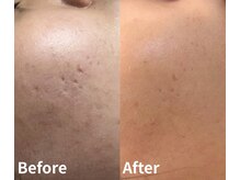 エルア 尼崎(Elua)/