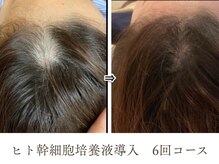 シーズ/ビフォーアフターその6