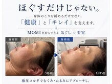 モミ(MOMI)の雰囲気（食いしばり、首肩コリ、眼精疲労、小顔、たるみに強圧コルギ◎）