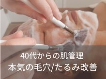 シェノン(Chainon)