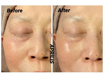 アプリリス(APRILIS)/エイジング肌改善に自信あり！