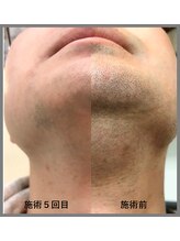 ファブ 鈴鹿店/お客様ビフォーアフター