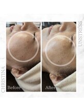 シャルムパリス(charme paris)/インナードラにも◎１回の変化