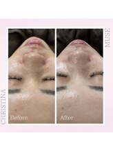 シャルムパリス(charme paris)/ごわつきレス♪１回の施術変化