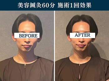 シンク(CINQ)/左右差頭蓋骨/骨格調整/美容鍼灸