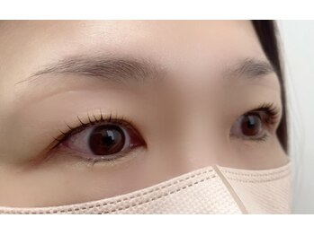 キアーロ(ChiaRo)/重ためまぶたの方