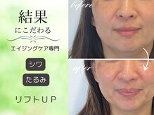 シーズボーテ(C's Beaute)