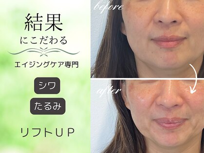 シーズボーテ(C's Beaute)の写真